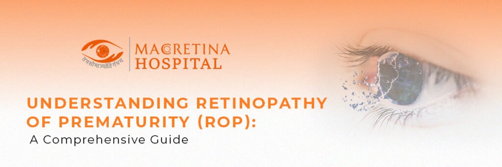 Understanding Retinopathy of Prematurity: A Comprehensive Guide