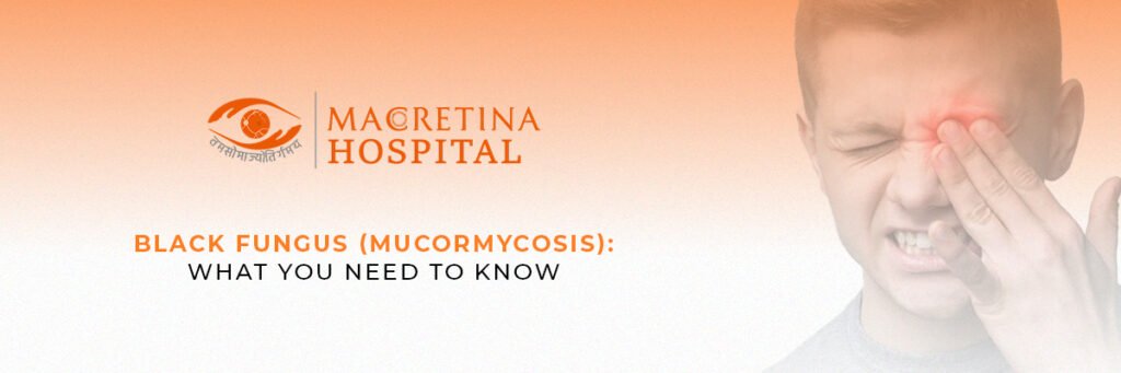 Black Fungus (Mucormycosis): What You Need to Know