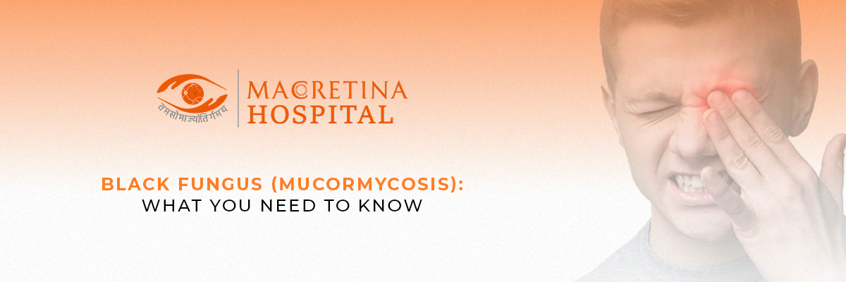 Black Fungus (Mucormycosis): What You Need to Know