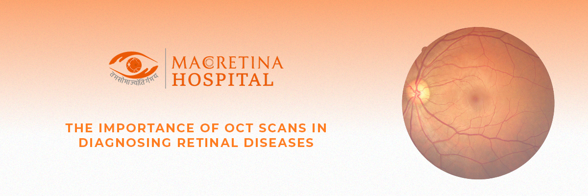 The Importance of OCT Scans in Diagnosing Retinal Diseases