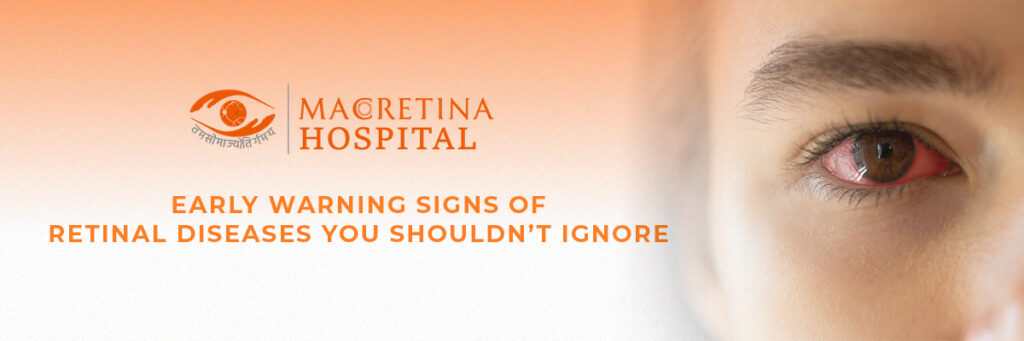 Early Warning Signs of Retinal Diseases You Shouldn’t Ignore
