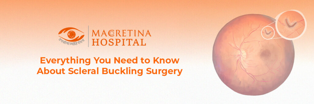 Everything You Need to Know About Scleral Buckling Surgery